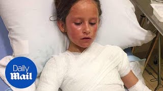 Child-helping-her-mom-cook-badly-burnt-after-pressure-cooker-explodes